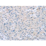 Immunohistochemistry - EI24 Antibody from Signalway Antibody (43165) - Antibodies.com