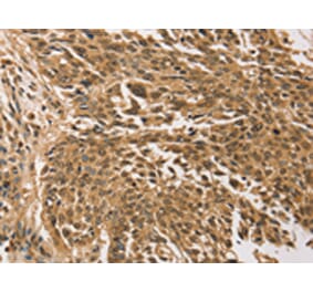 Immunohistochemistry - TGM7 Antibody from Signalway Antibody (43168) - Antibodies.com