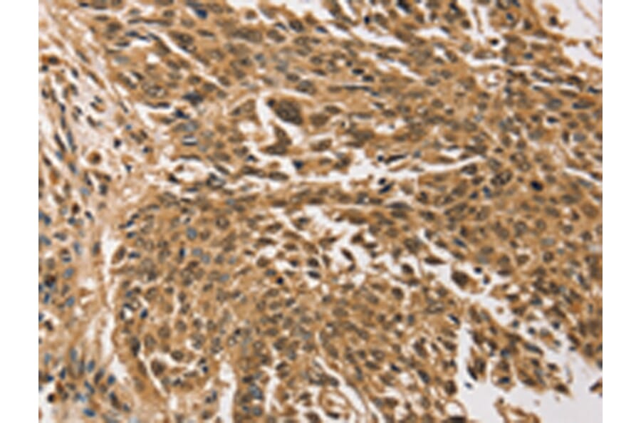 Immunohistochemistry - TGM7 Antibody from Signalway Antibody (43168) - Antibodies.com