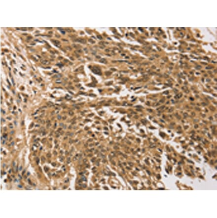 Immunohistochemistry - TGM7 Antibody from Signalway Antibody (43168) - Antibodies.com