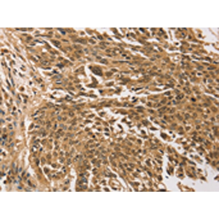 Immunohistochemistry - TGM7 Antibody from Signalway Antibody (43168) - Antibodies.com