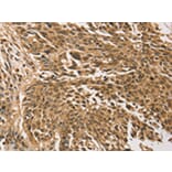 Immunohistochemistry - TGM7 Antibody from Signalway Antibody (43168) - Antibodies.com