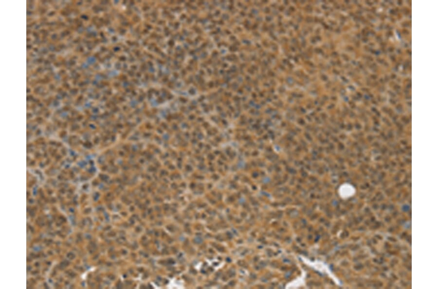 Immunohistochemistry - TGM7 Antibody from Signalway Antibody (43168) - Antibodies.com