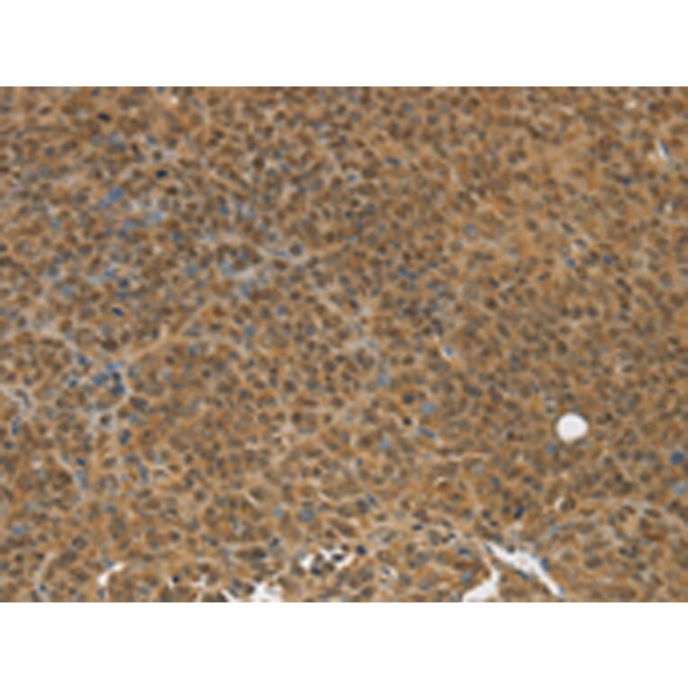 Immunohistochemistry - TGM7 Antibody from Signalway Antibody (43168) - Antibodies.com