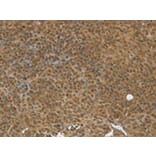 Immunohistochemistry - TGM7 Antibody from Signalway Antibody (43168) - Antibodies.com