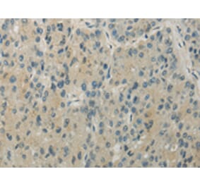 Immunohistochemistry - RHOU Antibody from Signalway Antibody (43196) - Antibodies.com