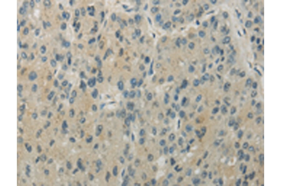 Immunohistochemistry - RHOU Antibody from Signalway Antibody (43196) - Antibodies.com