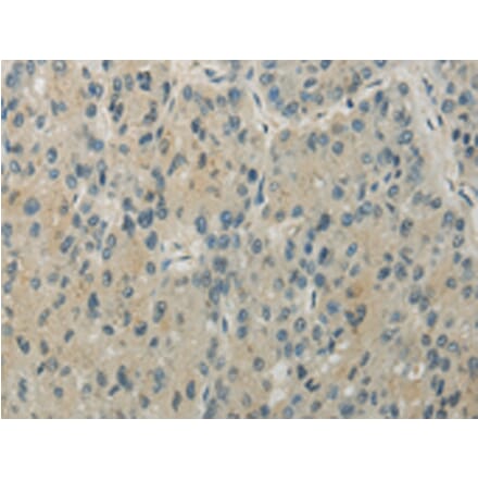 Immunohistochemistry - RHOU Antibody from Signalway Antibody (43196) - Antibodies.com