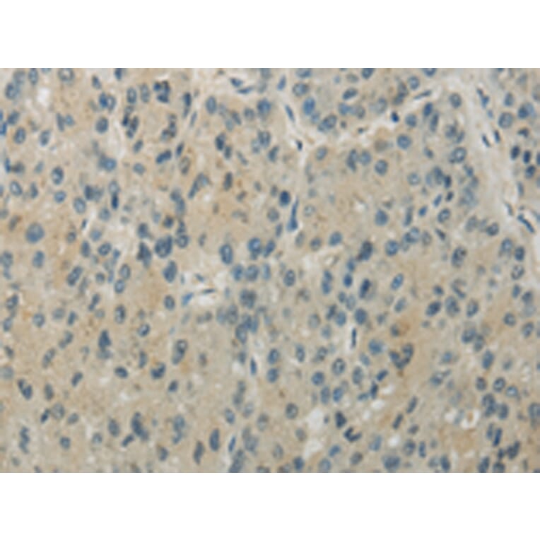Immunohistochemistry - RHOU Antibody from Signalway Antibody (43196) - Antibodies.com