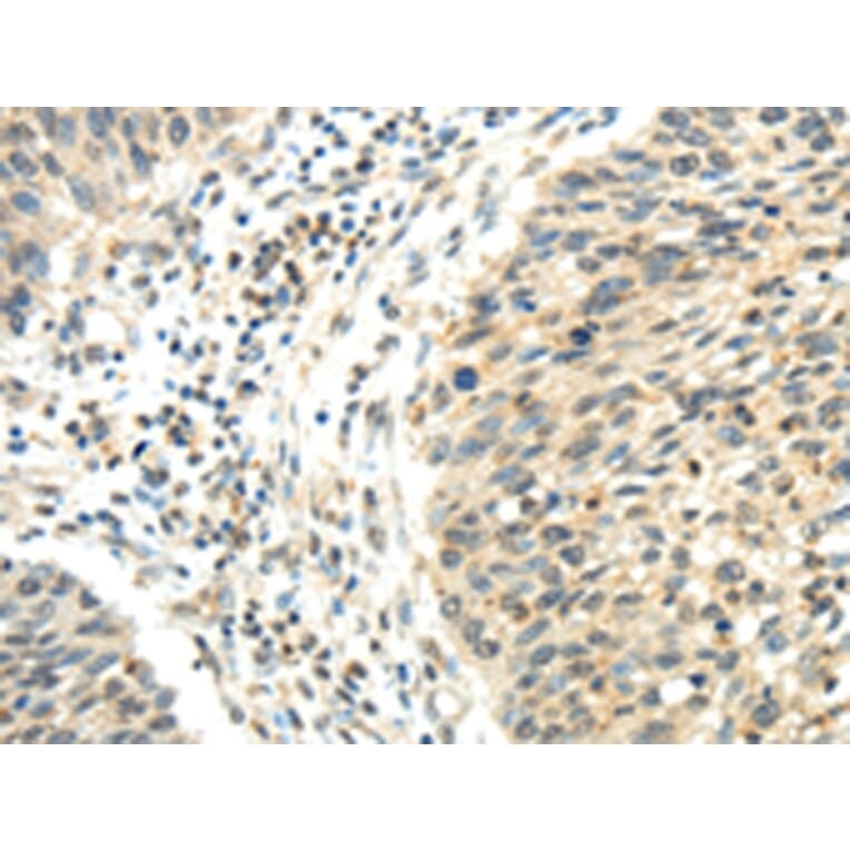Immunohistochemistry - RHOU Antibody from Signalway Antibody (43196) - Antibodies.com