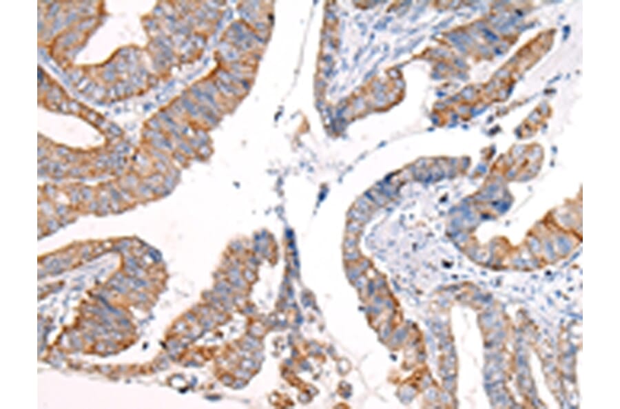 Immunohistochemistry - KRT7 Antibody from Signalway Antibody (43217) - Antibodies.com