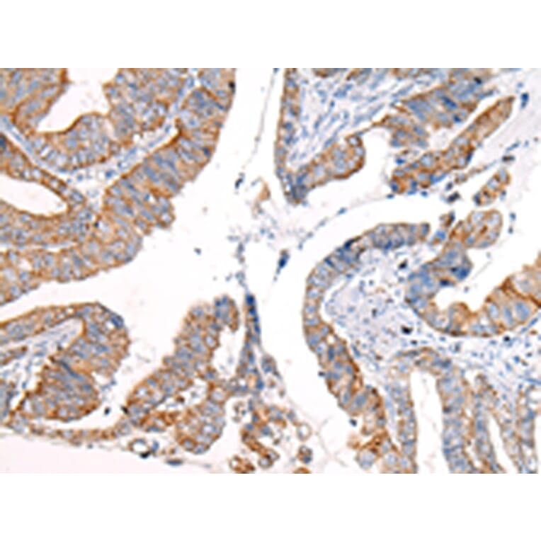 Immunohistochemistry - KRT7 Antibody from Signalway Antibody (43217) - Antibodies.com