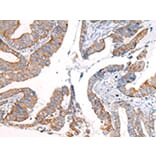 Immunohistochemistry - KRT7 Antibody from Signalway Antibody (43217) - Antibodies.com