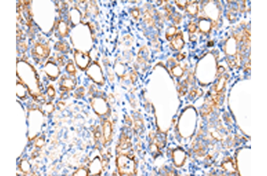 Immunohistochemistry - KRT7 Antibody from Signalway Antibody (43217) - Antibodies.com