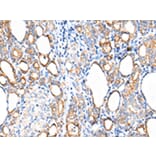 Immunohistochemistry - KRT7 Antibody from Signalway Antibody (43217) - Antibodies.com