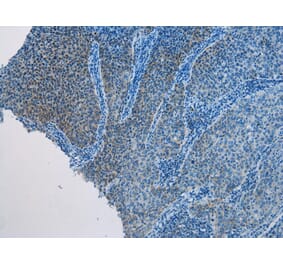 Immunohistochemistry - AQP7 Antibody from Signalway Antibody (43226) - Antibodies.com