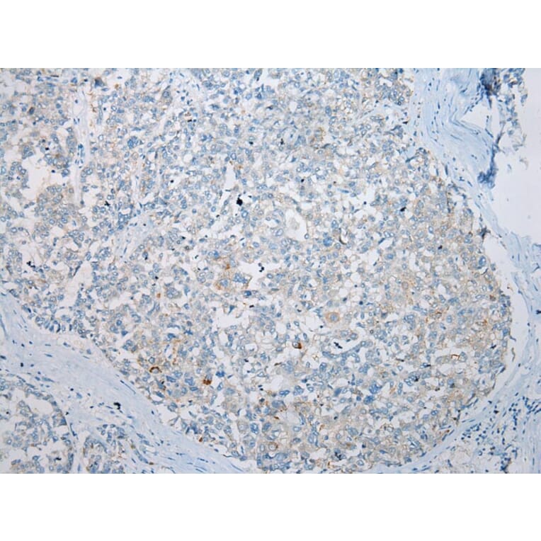 Immunohistochemistry - AQP7 Antibody from Signalway Antibody (43226) - Antibodies.com