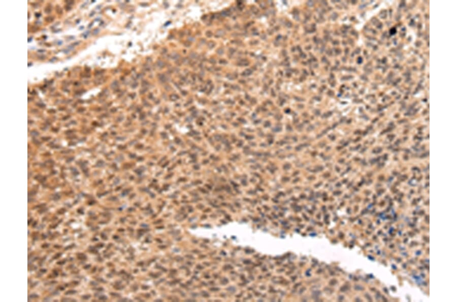Immunohistochemistry - ATF1 Antibody from Signalway Antibody (43228) - Antibodies.com