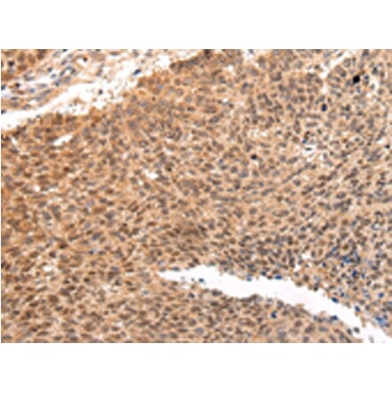 Immunohistochemistry - ATF1 Antibody from Signalway Antibody (43228) - Antibodies.com