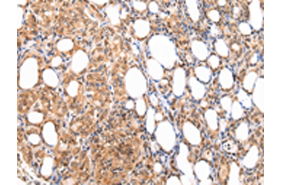 Immunohistochemistry - ATF1 Antibody from Signalway Antibody (43228) - Antibodies.com