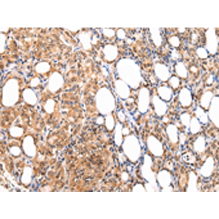 Immunohistochemistry - ATF1 Antibody from Signalway Antibody (43228) - Antibodies.com