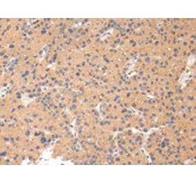 Immunohistochemistry - CTSK Antibody from Signalway Antibody (43232) - Antibodies.com