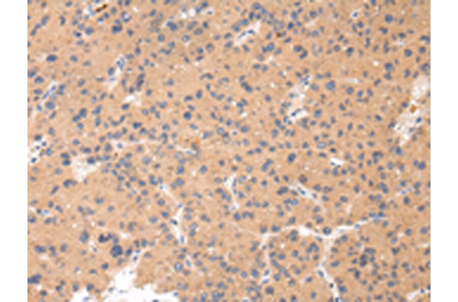 Immunohistochemistry - CTSK Antibody from Signalway Antibody (43232) - Antibodies.com