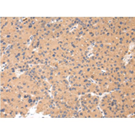 Immunohistochemistry - CTSK Antibody from Signalway Antibody (43232) - Antibodies.com