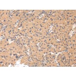 Immunohistochemistry - CTSK Antibody from Signalway Antibody (43232) - Antibodies.com