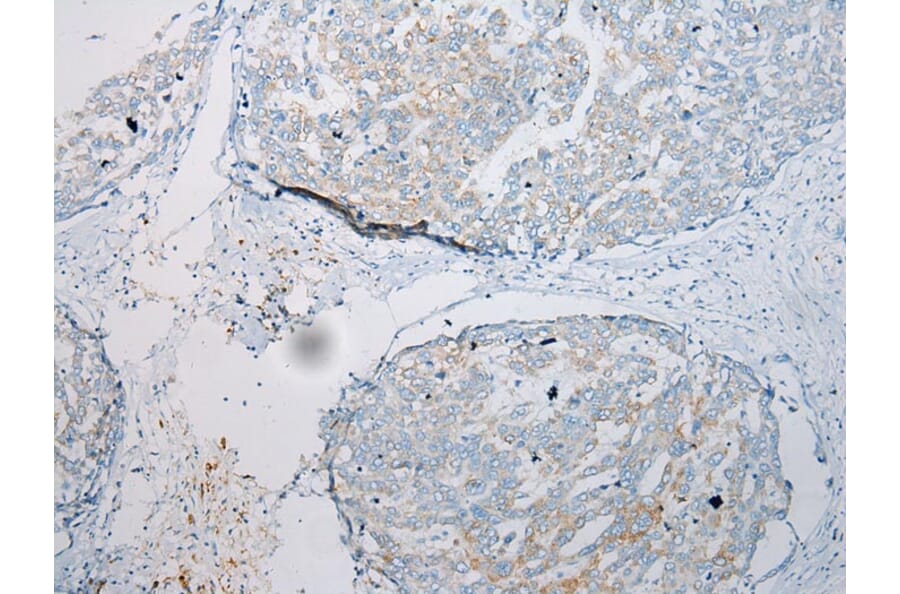 Immunohistochemistry - CCL7 Antibody from Signalway Antibody (43233) - Antibodies.com