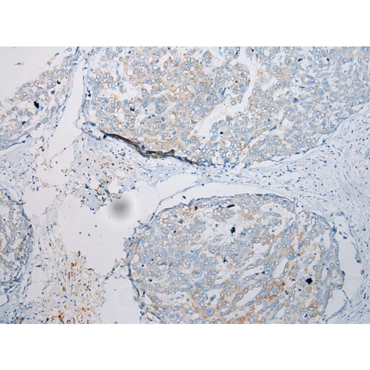 Immunohistochemistry - CCL7 Antibody from Signalway Antibody (43233) - Antibodies.com