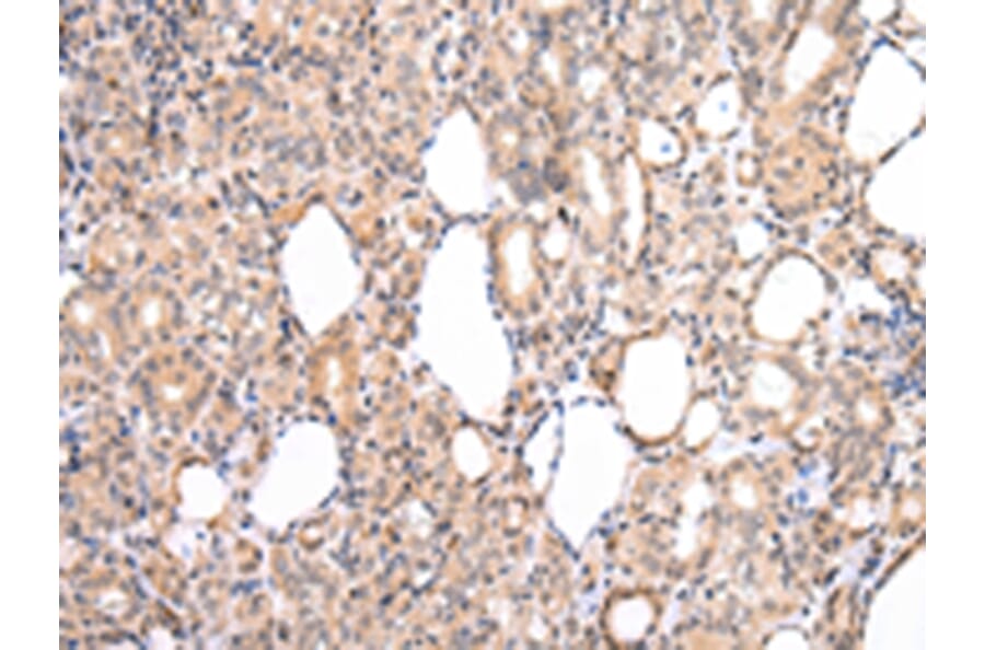 Immunohistochemistry - CDK8 Antibody from Signalway Antibody (43234) - Antibodies.com