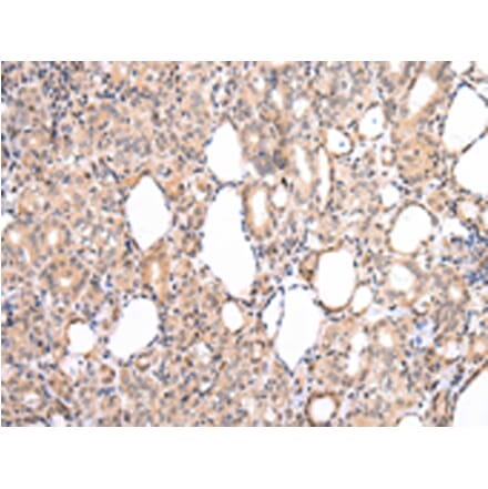 Immunohistochemistry - CDK8 Antibody from Signalway Antibody (43234) - Antibodies.com