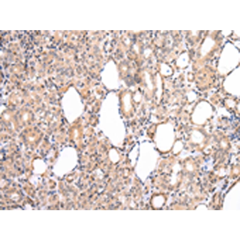 Immunohistochemistry - CDK8 Antibody from Signalway Antibody (43234) - Antibodies.com