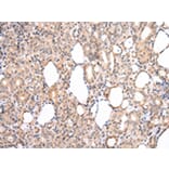 Immunohistochemistry - CDK8 Antibody from Signalway Antibody (43234) - Antibodies.com
