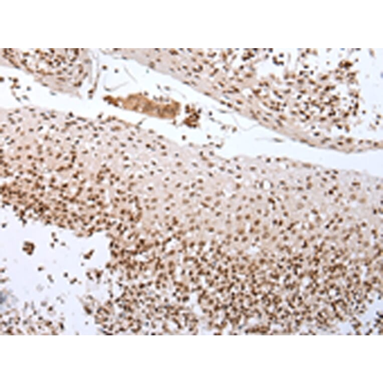 Immunohistochemistry - CUL1 Antibody from Signalway Antibody (43243) - Antibodies.com