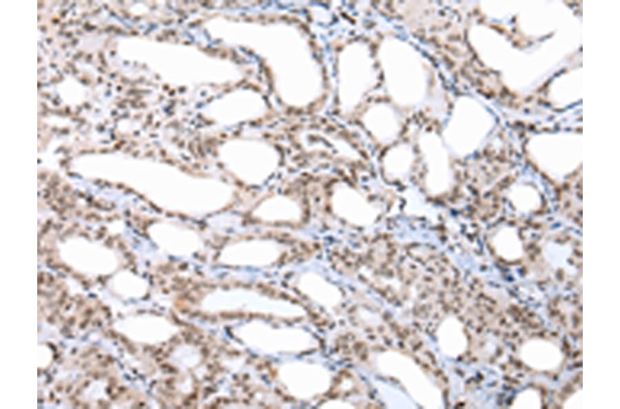 Immunohistochemistry - CUL1 Antibody from Signalway Antibody (43243) - Antibodies.com