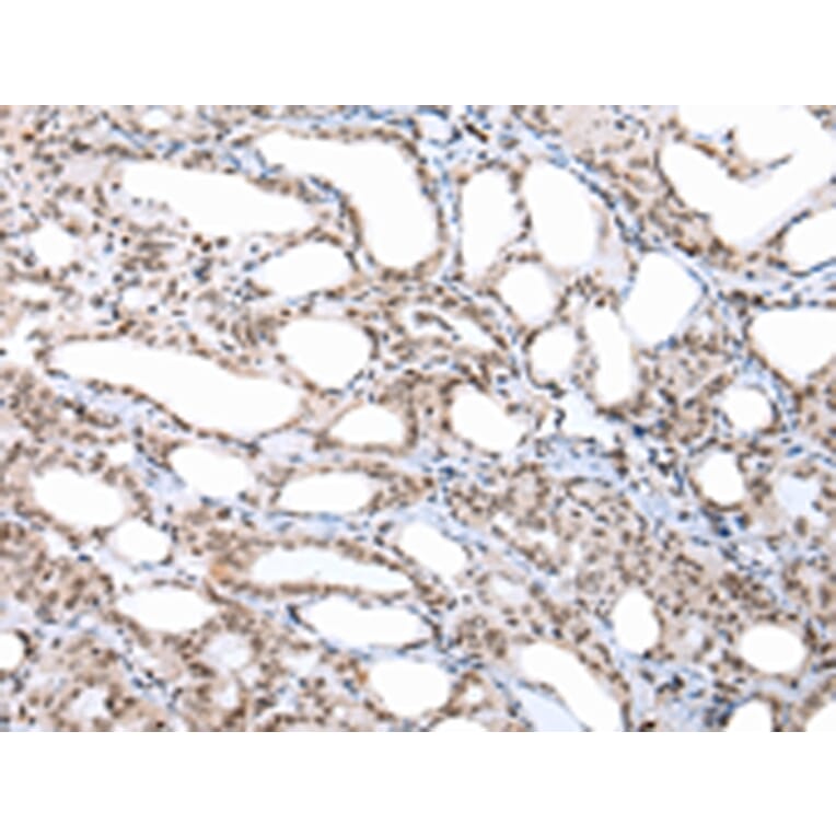 Immunohistochemistry - CUL1 Antibody from Signalway Antibody (43243) - Antibodies.com