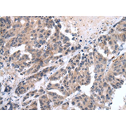 Immunohistochemistry - FIGF Antibody from Signalway Antibody (43245) - Antibodies.com