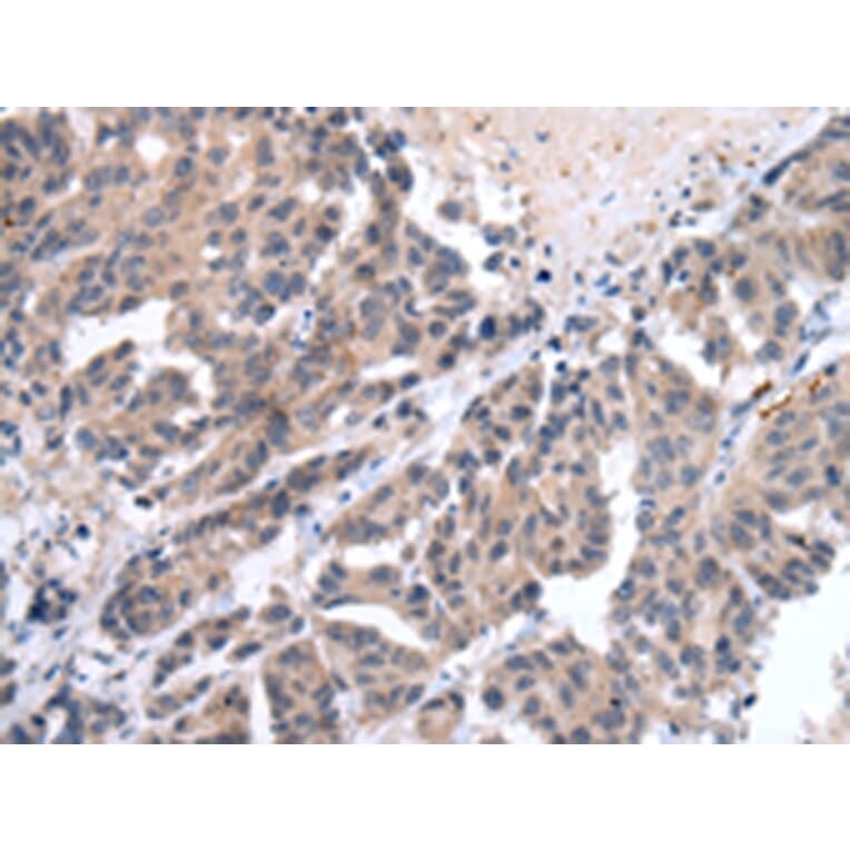 Immunohistochemistry - FIGF Antibody from Signalway Antibody (43245) - Antibodies.com