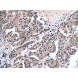 Immunohistochemistry - FIGF Antibody from Signalway Antibody (43245) - Antibodies.com