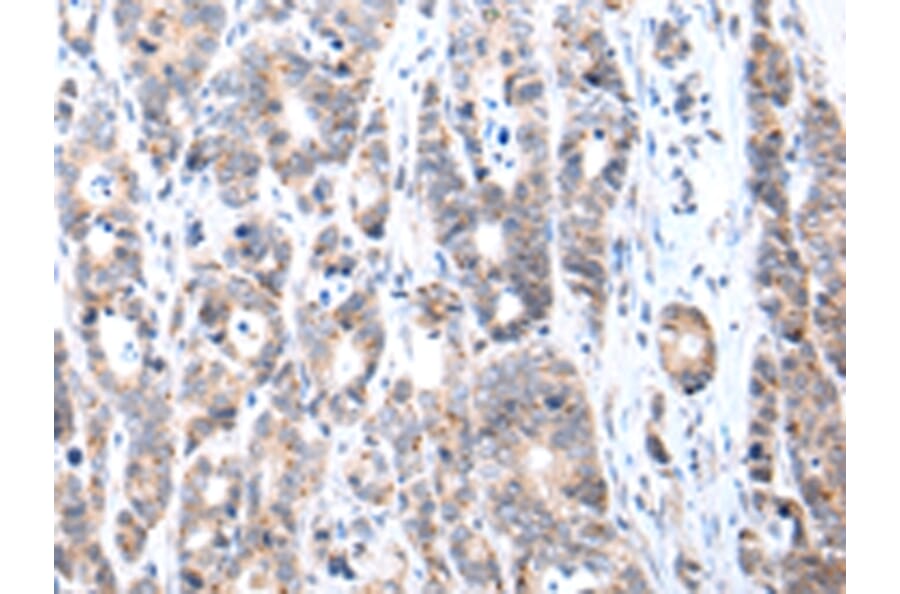 Immunohistochemistry - FIGF Antibody from Signalway Antibody (43245) - Antibodies.com