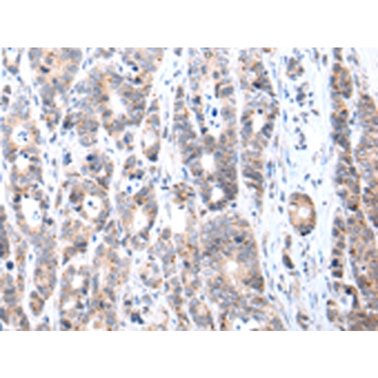 Immunohistochemistry - FIGF Antibody from Signalway Antibody (43245) - Antibodies.com