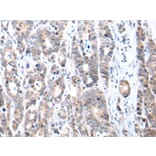 Immunohistochemistry - FIGF Antibody from Signalway Antibody (43245) - Antibodies.com