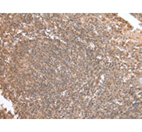 Immunohistochemistry - DVL1 Antibody from Signalway Antibody (43257) - Antibodies.com