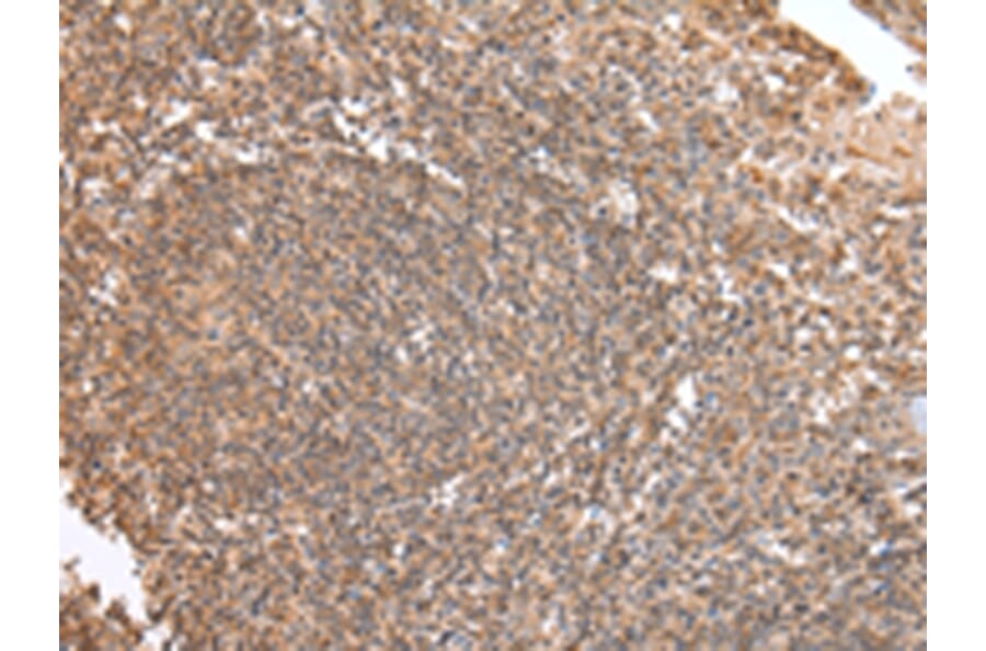 Immunohistochemistry - DVL1 Antibody from Signalway Antibody (43257) - Antibodies.com