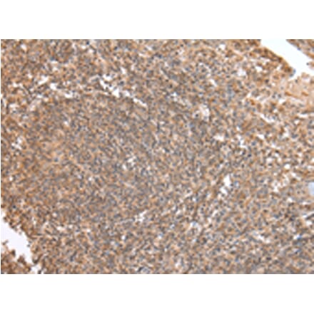 Immunohistochemistry - DVL1 Antibody from Signalway Antibody (43257) - Antibodies.com
