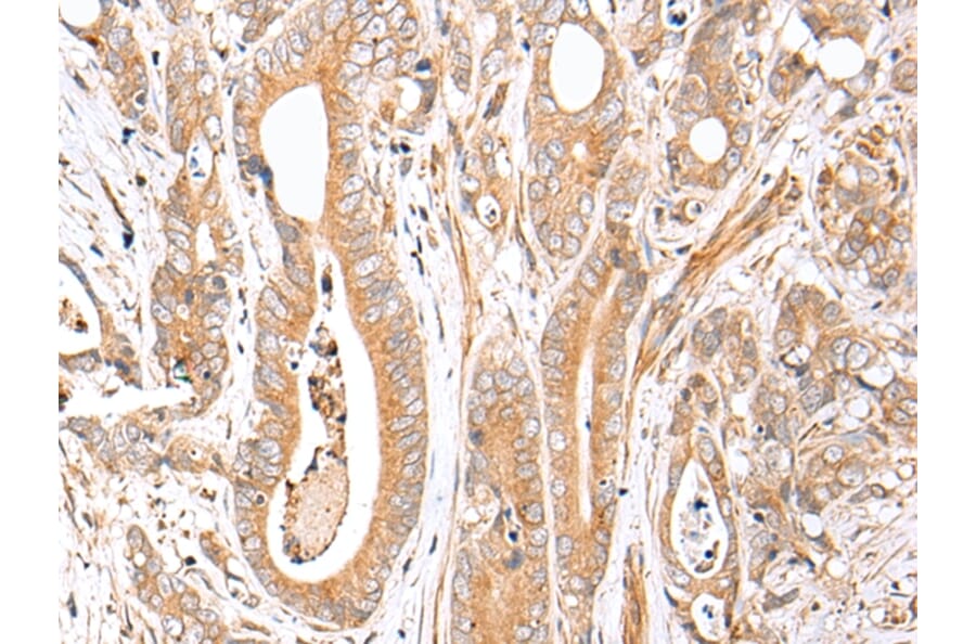 Immunohistochemistry - FPR1 Antibody from Signalway Antibody (43271) - Antibodies.com