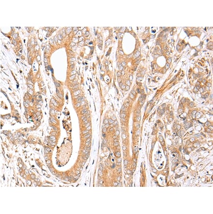 Immunohistochemistry - FPR1 Antibody from Signalway Antibody (43271) - Antibodies.com