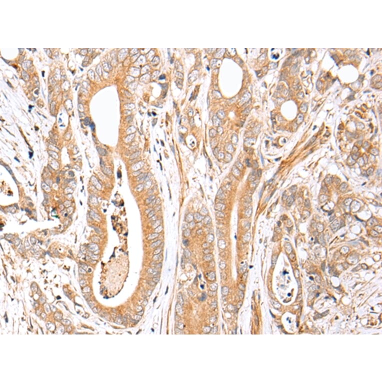 Immunohistochemistry - FPR1 Antibody from Signalway Antibody (43271) - Antibodies.com